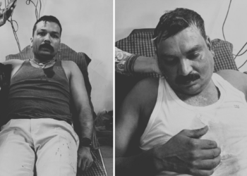 MP: पन्ना में पुलिस टीम पर हमला… थानेदार-कॉन्स्टेबल घायल, 8 पुलिसकर्मी हथियार छोड़ जान बचाकर भागे