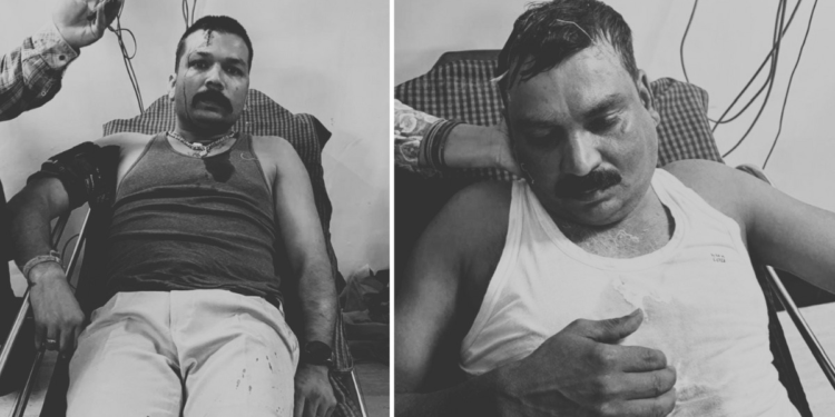 MP: पन्ना में पुलिस टीम पर हमला… थानेदार-कॉन्स्टेबल घायल, 8 पुलिसकर्मी हथियार छोड़ जान बचाकर भागे