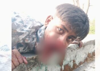 हीरोगिरी पड़ी भारी… मुंह में सुतली बम फोड़ रहा था 18 साल का रोहित, हुआ तेज धमाका; जबड़े के उड़ गए चिथड़े