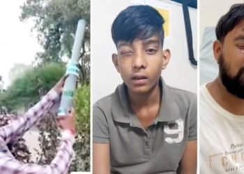 देसी बंदूक से दिवाली काली… ₹150 की कार्बाइड गन, छीन ले गई 125 आंखों की रोशनी