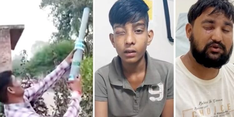 देसी बंदूक से दिवाली काली… ₹150 की कार्बाइड गन, छीन ले गई 125 आंखों की रोशनी