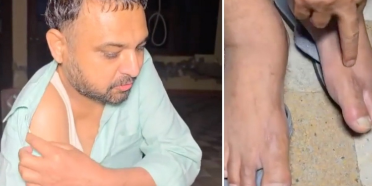 35 लाख खर्च, 25 घंटे बेड़ियों में कैद… अंबाला के हरजिंदर ने बयां किया अमेरिका से वापसी का दर्द