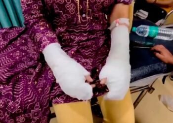 छात्रा ने खुद ही अपने ऊपर डाला था ‘एसिड’,  CCTV से खुली पोल… दिल्ली कांड की पूरी क्रोनोलॉजी