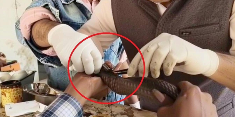 उज्जैन में अनोखे ऑपरेशन से 80 टांकों से जहरीले कोबरा की जान बचाई गई, जानिए पूरी कहानी