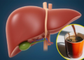 लिवर हेल्थ के लिए जरूरी: फैटी लिवर से बचाने वाला यह खास ड्रिंक पिएं और स्वस्थ रहें