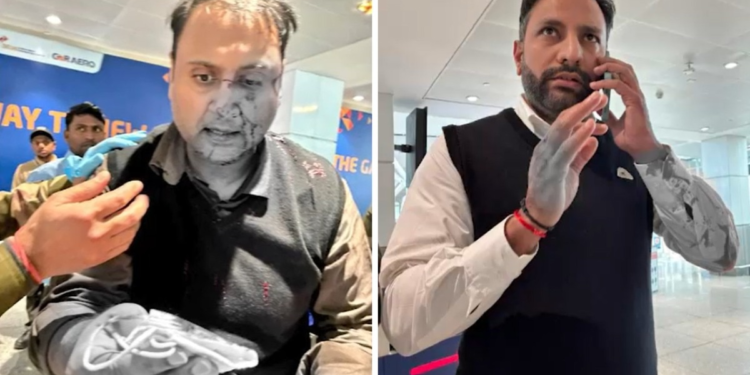 दिल्ली एयरपोर्ट पर हंगामा, पायलट ने पैसेंजर को 7 साल की बेटी के सामने पीटा, सदमे में आया परिवार