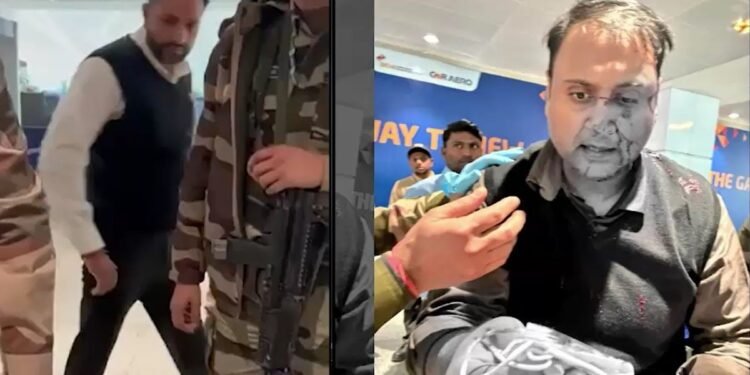 टूट गई है नाक की हड्डी… दिल्ली एयरपोर्ट पर Air India के पायलट द्वारा पीटे गए शख्स की आई रिपोर्ट