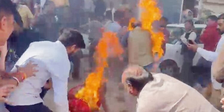 देवास: नाली से अतिक्रमण हटाने पर पति-पत्नी ने खुद को लगाई आग, भड़की भीड़ ने किया जेसीबी पर पथराव