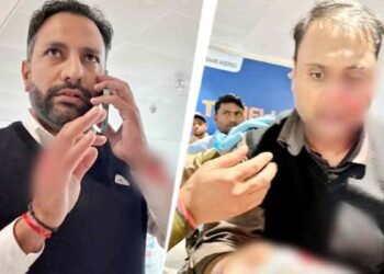 IGI एयरपोर्ट पर यात्री को पीटने वाले पायलट पर FIR दर्ज, अंकित दीवान की टूटी नाक की हड्डी
