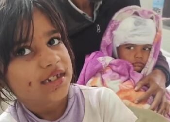 छोटे भाई के लिए आवारा कुत्ते से भिड़ी 8 साल की मासूम, 3 मिनट तक लड़ती रही, फिर अपनी टी- शर्ट बांधकर रोका खून