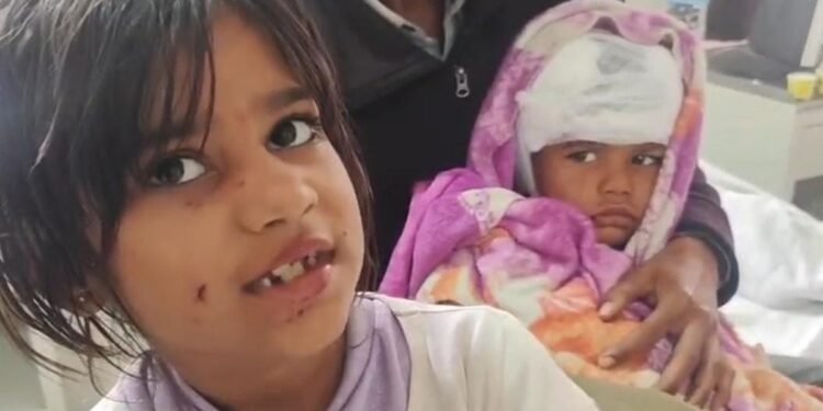 छोटे भाई के लिए आवारा कुत्ते से भिड़ी 8 साल की मासूम, 3 मिनट तक लड़ती रही, फिर अपनी टी- शर्ट बांधकर रोका खून