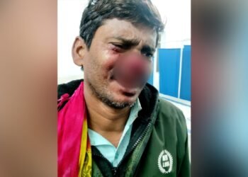 बिहार: हंसी-मजाक करना पड़ा भारी, गुस्साए चचेरे भाई ने तलवार उठाई और काट दी बड़े भाई की नाक