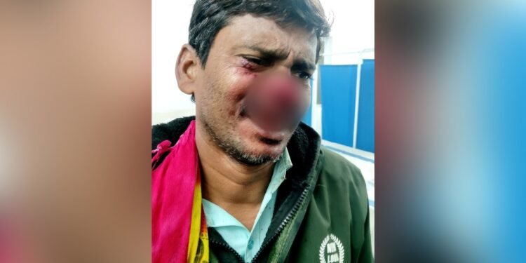 बिहार: हंसी-मजाक करना पड़ा भारी, गुस्साए चचेरे भाई ने तलवार उठाई और काट दी बड़े भाई की नाक