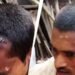 बिहार: सिर फटने पर डॉक्टर ने टांकों की जगह लगा दी स्टेपलर पिन, Video Viral
