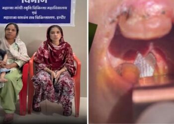 इंदौर: एक साल के बच्चे के गले में फंसी जिंदा मछली, खेल-खेल में निगल गया था, डॉक्टरों ने ऑपरेशन कर बचाई जान