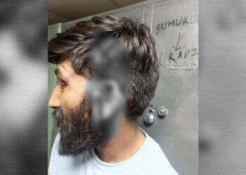 दिल्ली: पेशाब करने के विवाद में 2 युवकों की बुरी तरह पिटाई, लगाने पड़े 35 टांके
