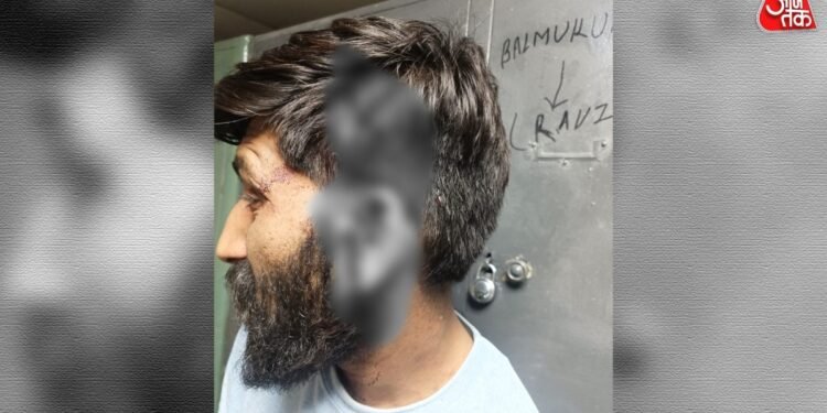 दिल्ली: पेशाब करने के विवाद में 2 युवकों की बुरी तरह पिटाई, लगाने पड़े 35 टांके