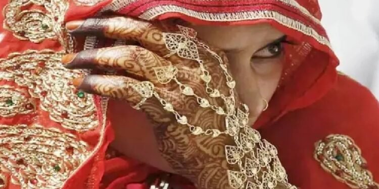 दुल्हन के चेहरे पर लगी हल्दी, हुआ ऐसा रिएक्शन कि ICU में करना पड़ा भर्ती