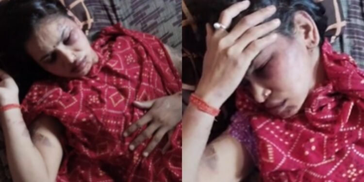शक ने बनाया शैतान! SAF आरक्षक ने पत्नी पर ढाया कहर, शरीर पर 7 जगह दिए जलने के जख्म