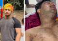 ‘आंखों की रोशनी जाने का खतरा’, जंतर-मंतर प्रोटेस्ट में घायल 19 साल के साहिल पर परिवार का दावा