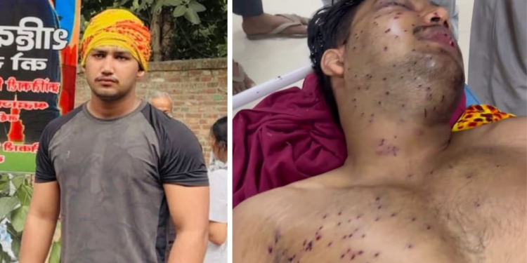 ‘आंखों की रोशनी जाने का खतरा’, जंतर-मंतर प्रोटेस्ट में घायल 19 साल के साहिल पर परिवार का दावा