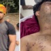 ‘आंखों की रोशनी जाने का खतरा’, जंतर-मंतर प्रोटेस्ट में घायल 19 साल के साहिल पर परिवार का दावा