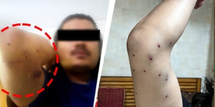 Exclusive: दिल्ली में चली पैलेट गन… घायल प्रदर्शनकारी के जख्म-मेडिकल रिपोर्ट दे रहे गवाही