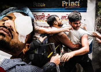 ‘चेहरे-गर्दन में धंसे थे पैलेट, आंख के पास कट…’, CJP प्रदर्शनकारी 4 दिन बाद डिस्चार्ज