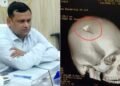 छपरा में पथराव का शिकार हुए BDO के सिर की सर्जरी, हालात संभालने गए थे, खुद पहुंच गए अस्पताल