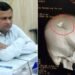 छपरा में पथराव का शिकार हुए BDO के सिर की सर्जरी, हालात संभालने गए थे, खुद पहुंच गए अस्पताल