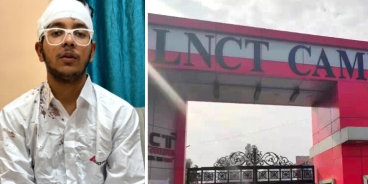 ‘कॉलेज में नए आए हो, सही से बात किया करो…’, भोपाल के LNCT में जूनियर छात्र से बर्बरता, सीनियर्स पर FIR; सिर पर आए 5 टांके