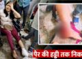 आग बुझाने का अभ्यास बन गया आफत! फायर ब्रिगेड ने महिला के पैर को कुचला, पति की कमर भी चोटिल; हादसे का लाइव वीडियो