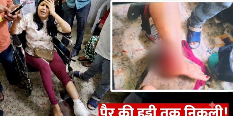 आग बुझाने का अभ्यास बन गया आफत! फायर ब्रिगेड ने महिला के पैर को कुचला, पति की कमर भी चोटिल; हादसे का लाइव वीडियो