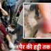 आग बुझाने का अभ्यास बन गया आफत! फायर ब्रिगेड ने महिला के पैर को कुचला, पति की कमर भी चोटिल; हादसे का लाइव वीडियो